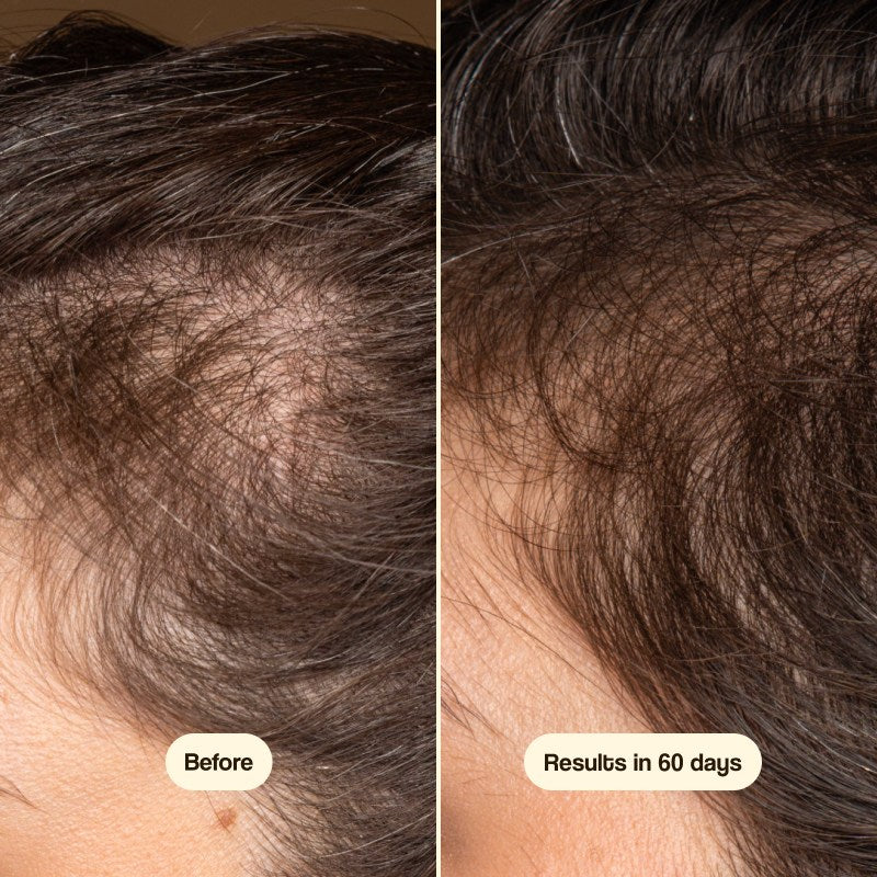 Freshly Cosmetics Hair Growth & Density Treatment 50ml - FRESHLY COSMETICS - cosmética natural