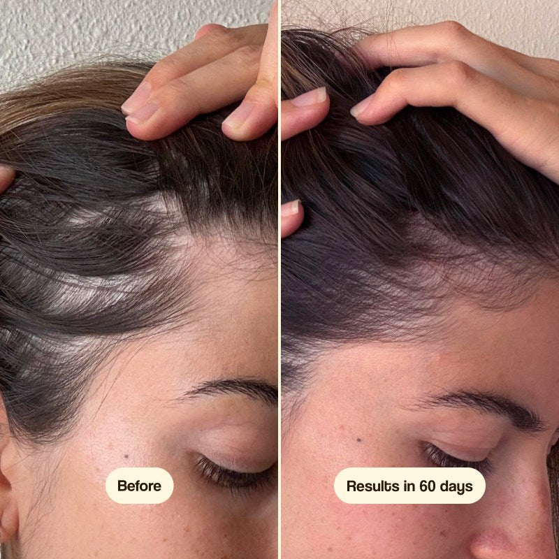 Freshly Cosmetics Hair Growth & Density Treatment 50ml - FRESHLY COSMETICS - cosmética natural