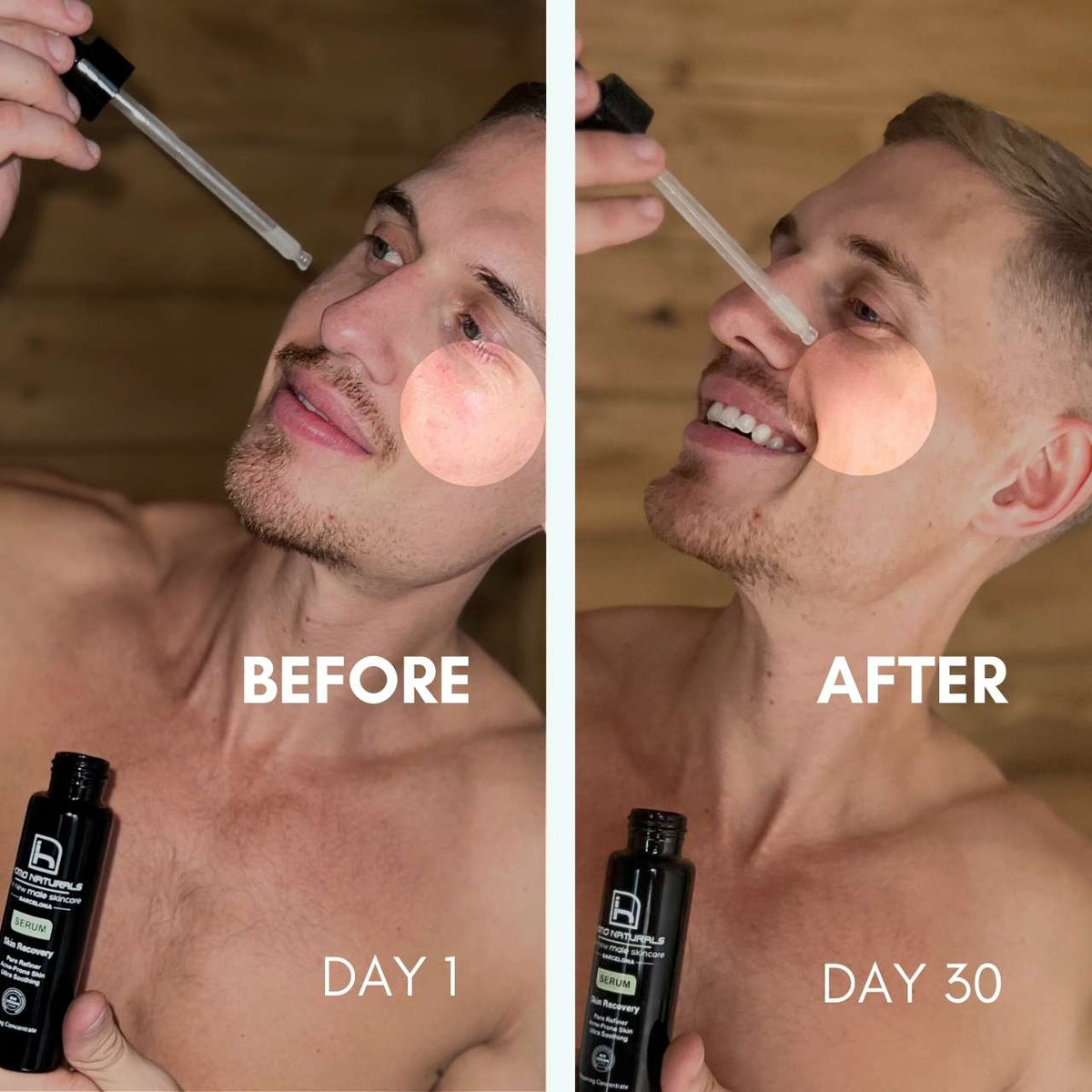 Homo Naturals Skin Recovery Sérum Facial Piel Sensible 100ml - foto 6