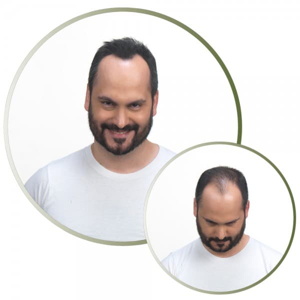 Kmax Fibras Capilares 32GR
