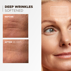 Huygens Crema Reafirmante de Colágeno 50ml - antes y después